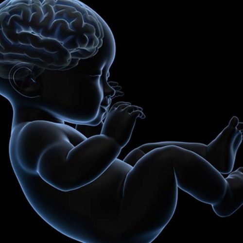 Encefalopatía isquémica hipóxica neonatal (HIE) | Abogado de Lesiones de Nacimiento de The Lidji Firm